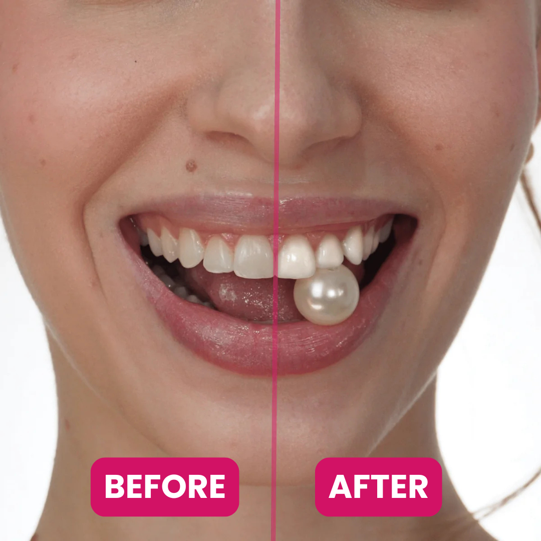 Smilie - Teeth Whitening Strips